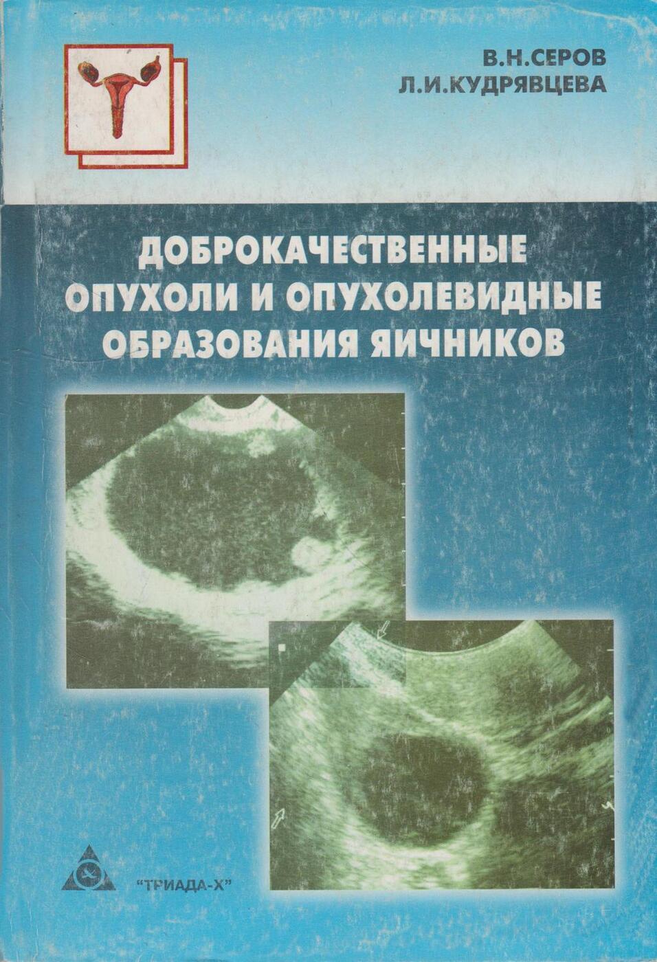 Презентация опухоли и опухолевидные образования яичников