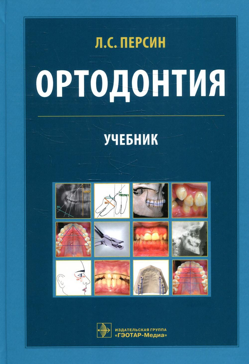современная ортодонтия — проффит уильям 2019. книги по ортодонтии. книги по ортодонтии. трезубов ортопедическая стоматология. книги по ортодонтии.