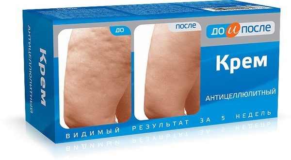Крем до и после моделирующий отзывы До и После Антицеллюлитный крем, 100мл - купить с доставкой по выгодным ценам в 