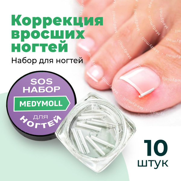 Корректор вросшего ногтя 10 шт купить на OZON по низкой цене (1302462376)