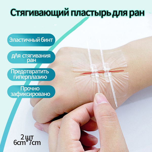 Пластырь стяжка для стягивания ран Без шрамов 2 пряжка ,6CM*7CM ...