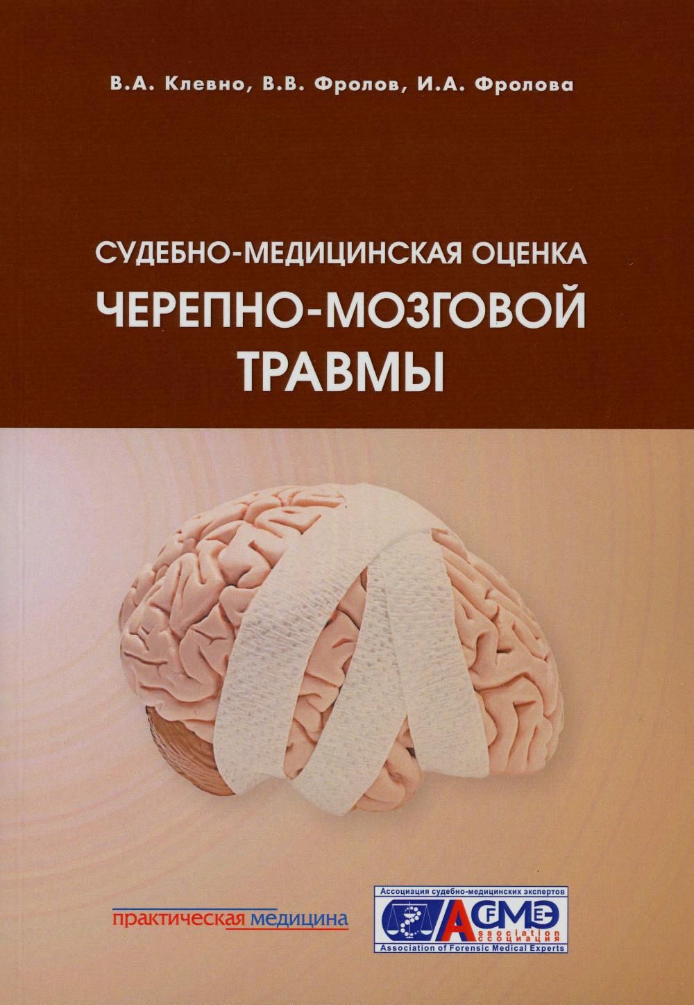 Судебно-медицинская оценка черепно-мозговой травмы: Учебное пособие |  Клевно Владимир Александрович - купить с доставкой по выгодным ценам в  интернет-магазине OZON (827450695)