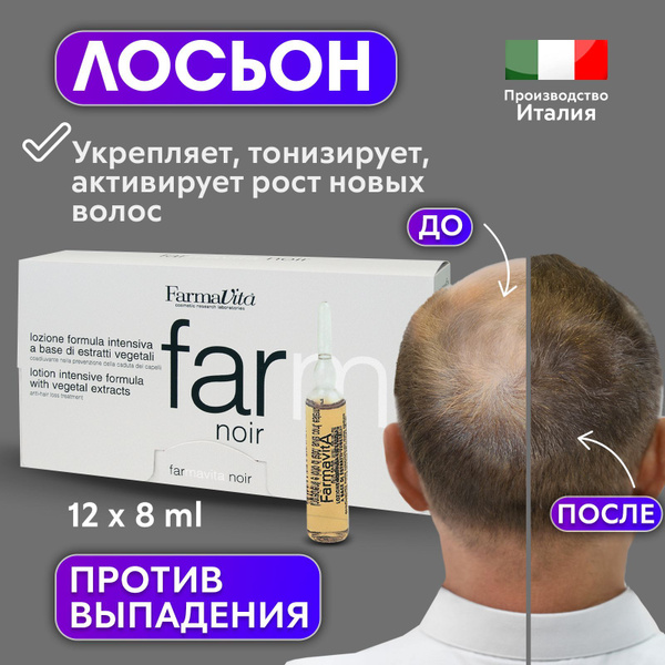 FARMAVITA / Против выпадения Ампулы, Лосьон мужской, Предупреждает ...