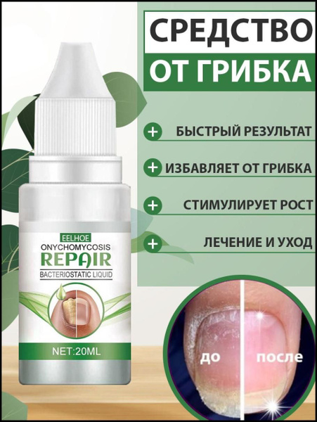 EELHOE Средство для ногтей, профилактика и лечение от грибка ...