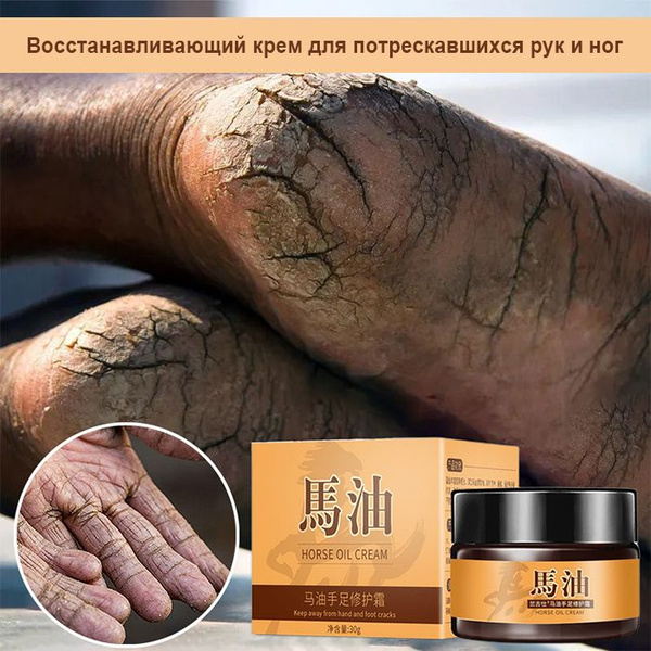 крем для ног от трещин 30 г с Мочевиной Увлажняйте и питайте сухой и ...