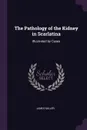 The Pathology of the Kidney in Scarlatina. Illustrated by Cases - James Miller
