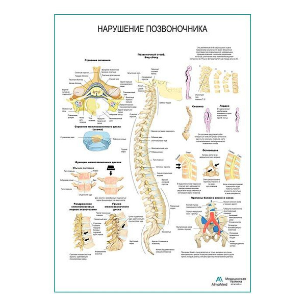 Плакат позвоночник и болезни медицинский фото