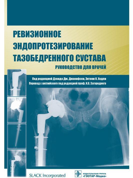 Ревизионное эндопротезирование тазобедренного сустава : руководство для ...