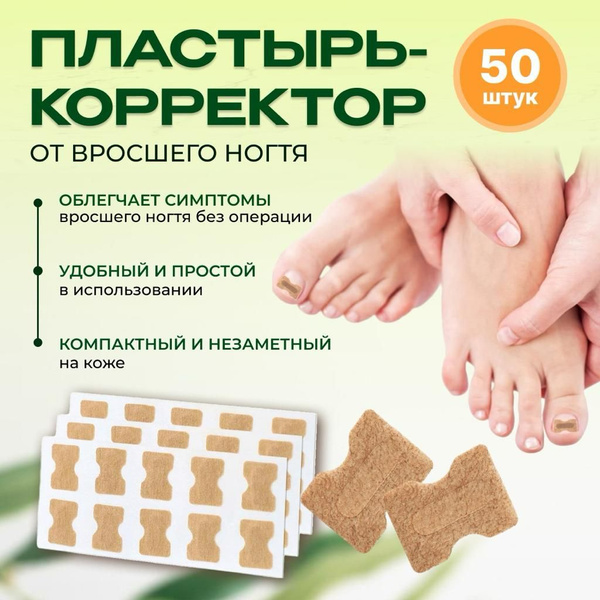 Пластырь для коррекции вросшего ногтя купить на OZON по низкой цене ...