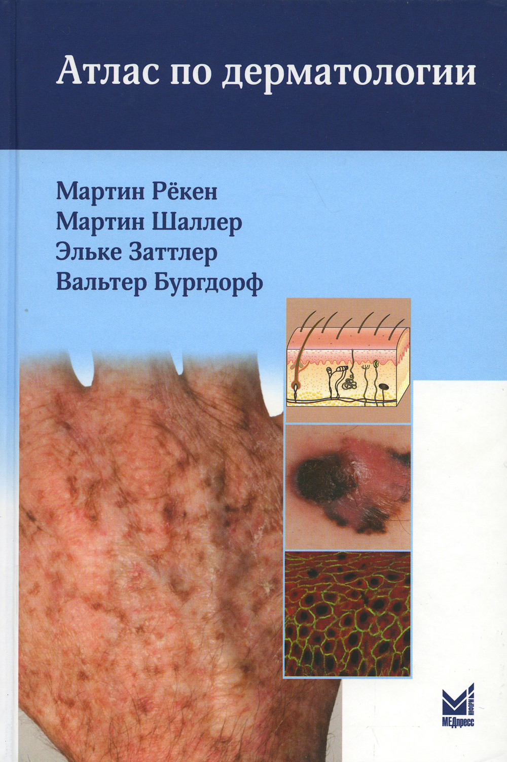 Учебник по дерматовенерологии с картинками