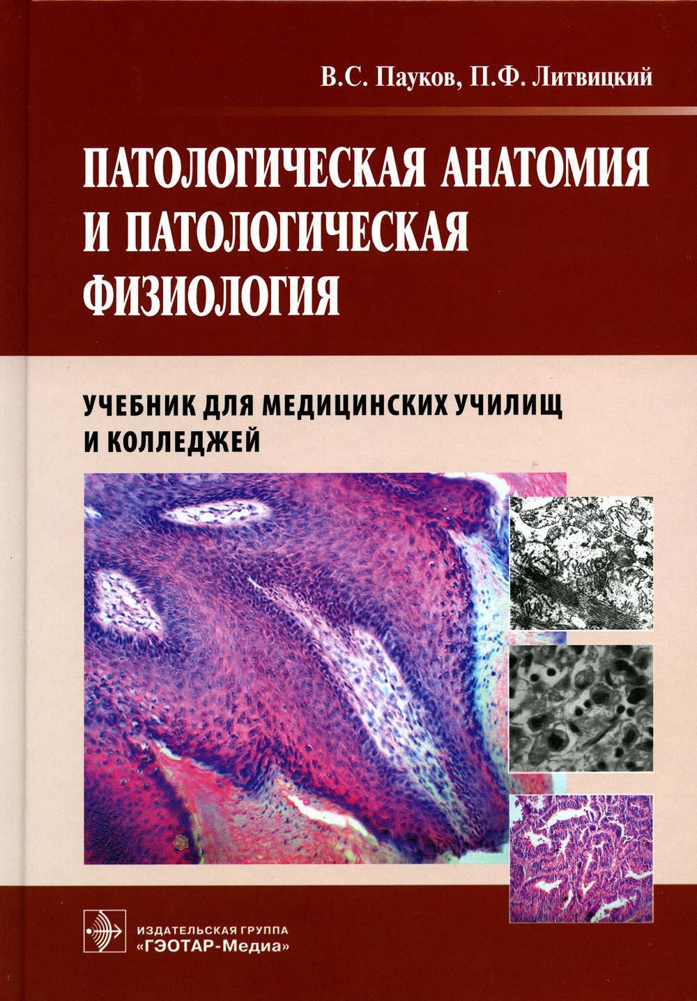 Фролов патофизиология в рисунках таблицах и схемах