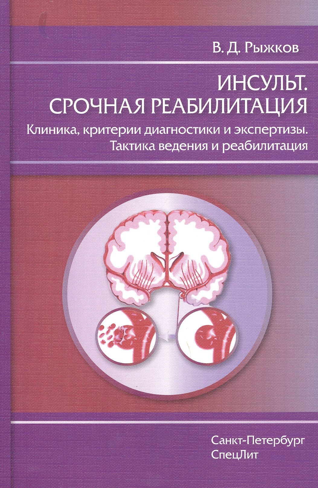 Семашко реабилитация после инсульта. Инсульт. инсульты учебники. реабилитация после инсульта книги.