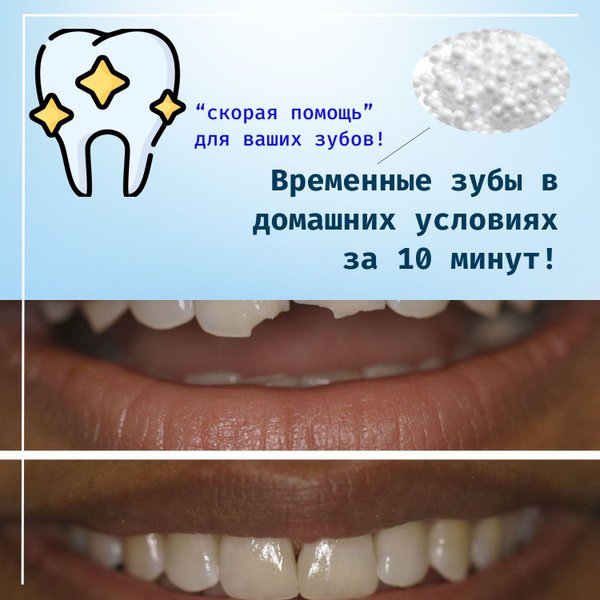 Как снять временную пломбу самостоятельно с зуба