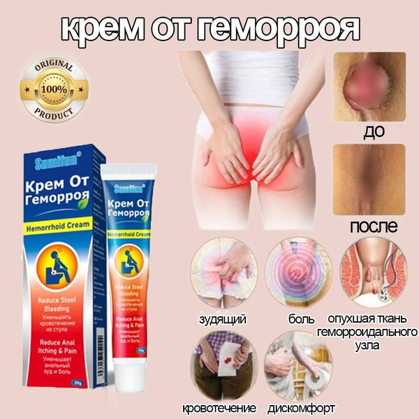Мазь от геморроя, Китайская чудо мазь, для зуда, анальных трещин, узлов ...