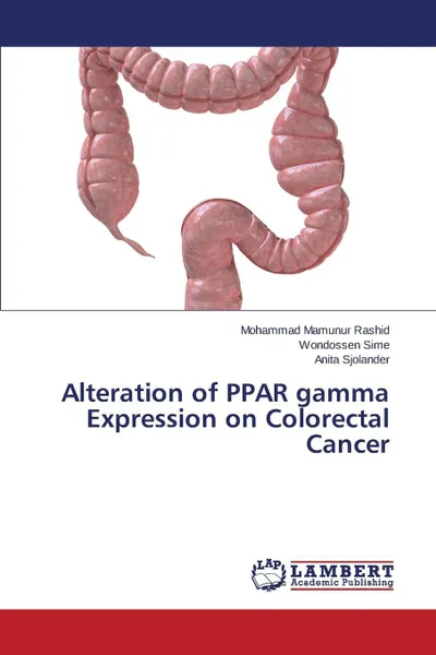 Обложка книги Alteration of PPAR gamma Expression on Colorectal Cancer, Rashid Mohammad Mamunur, Sime Wondossen, Sjolander Anita