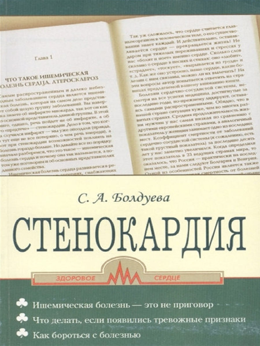 Стенокардия книги. Стенокардия книга. Болдуева с. "стенокардия". Синдром стенокардии симптомы.