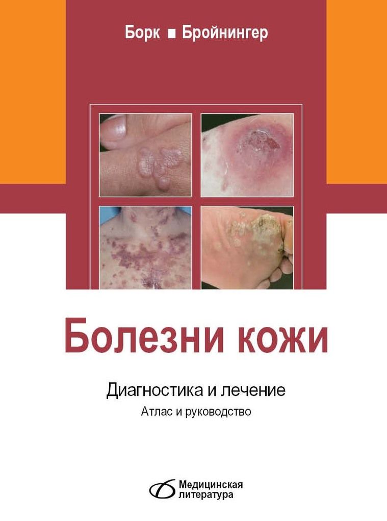 Болезни кожи фото и лечение