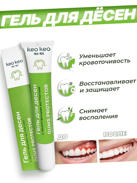 Бальзам Гель для чувствительных зубов и десен keo keo от воспаления и ...