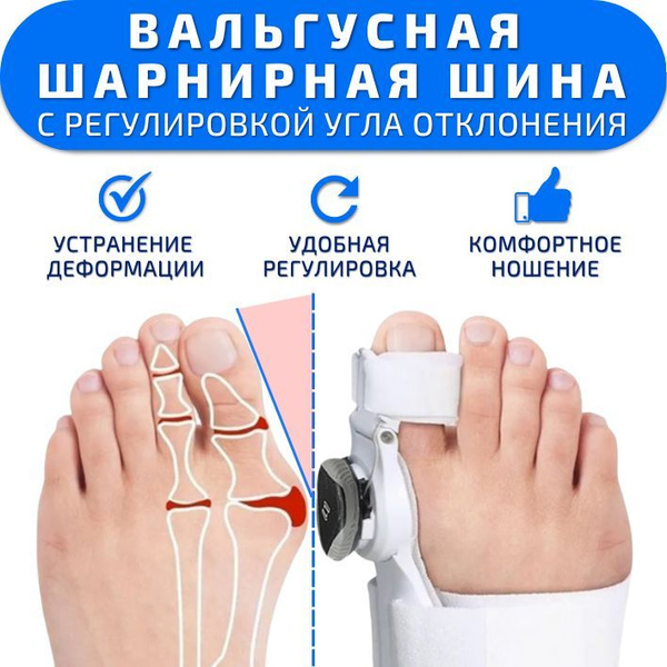 Вальгусная шарнирная шина ORTGUT ROTATE FIX с регулировкой угла ...