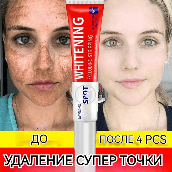 Крем для отбеливания и борьбы с веснушками ниацинамид удаляет меланин и ...