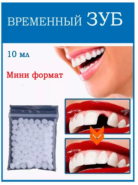 Материал пломбировочный временный (HOMTOPY). Пломба зубная для ремонта ...