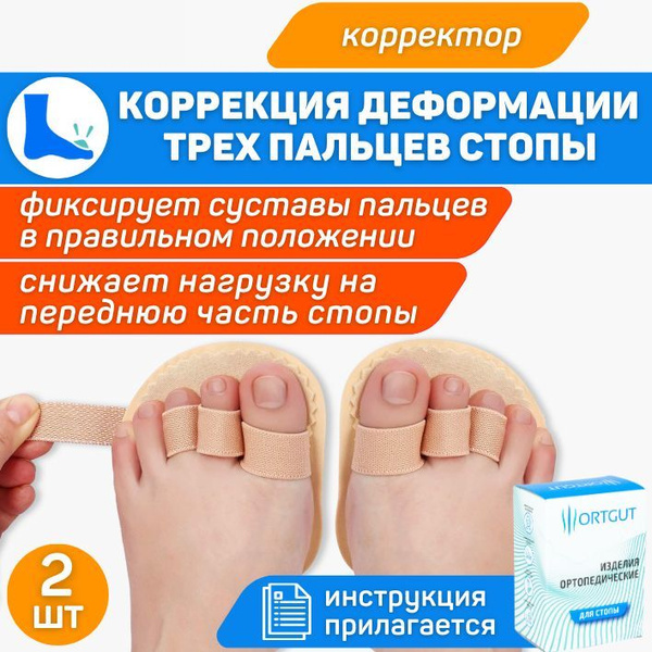 ORTGUT Корректор при молоткообразной и когтеобразной деформации пальцев ...