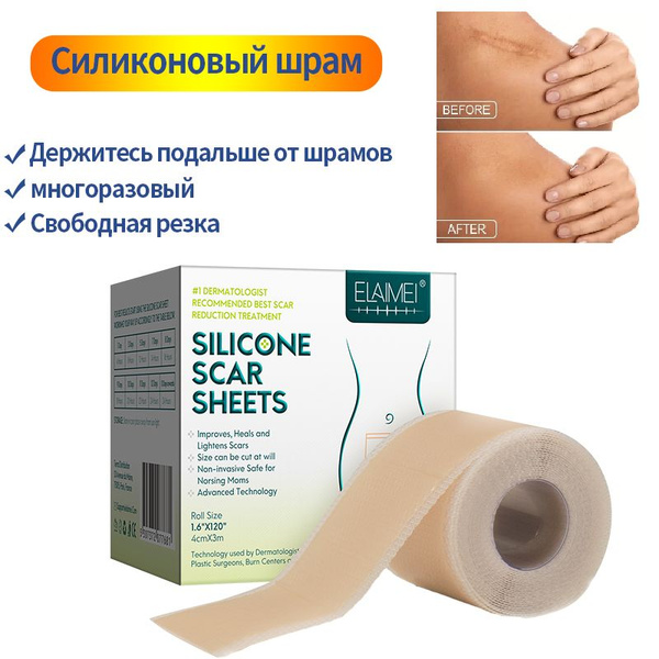ELAIMEI Лейкопластырь силиконовый от шрамов и рубцов после КС и ...