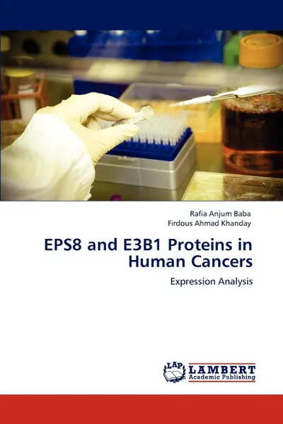 Обложка книги Eps8 and E3b1 Proteins in Human Cancers, Rafia Anjum Baba, Firdous Ahmad Khanday