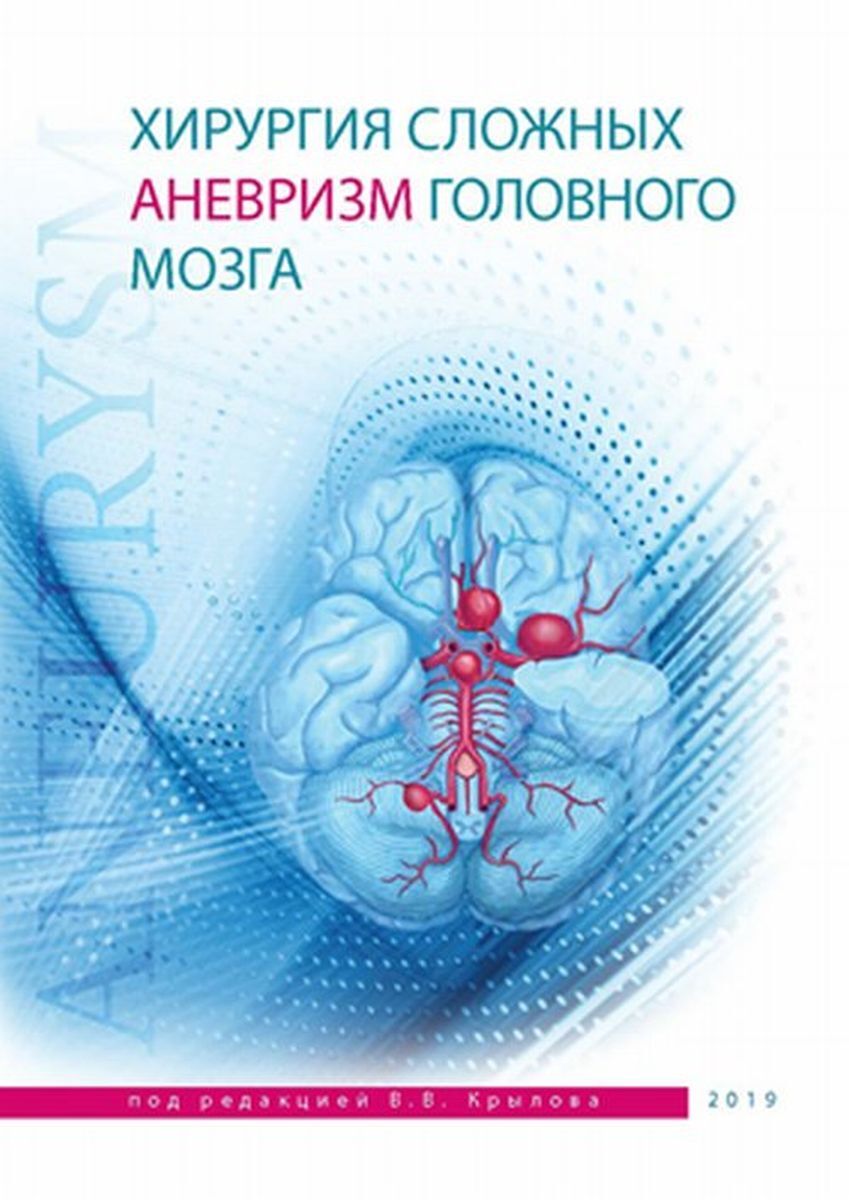 Хирургия сложных аневризм головного мозга - купить с доставкой по выгодным  ценам в интернет-магазине OZON (267038066)