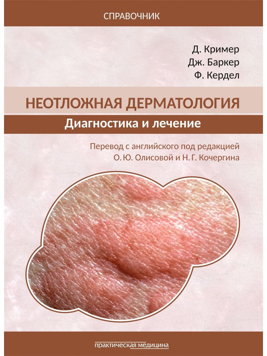 диагноз дерматологии. осмотр кожи. диагноз дерматологии. дифференциальная диагностика венерических заболеваний таблица. дерматоскопия прибор.