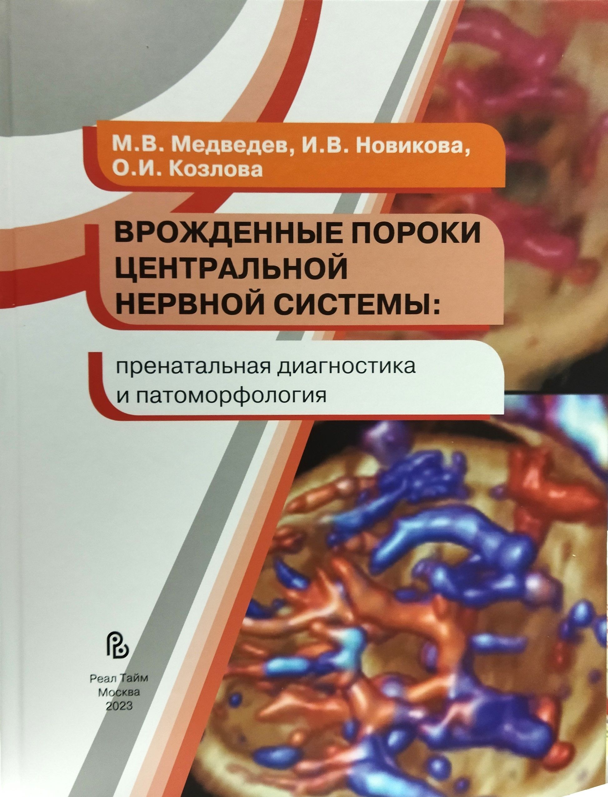 Врожденные пороки центральной нервной системы. 2023г. | Новикова И. В.,  Медведев М. В. - купить с доставкой по выгодным ценам в интернет-магазине  OZON (1271543121)