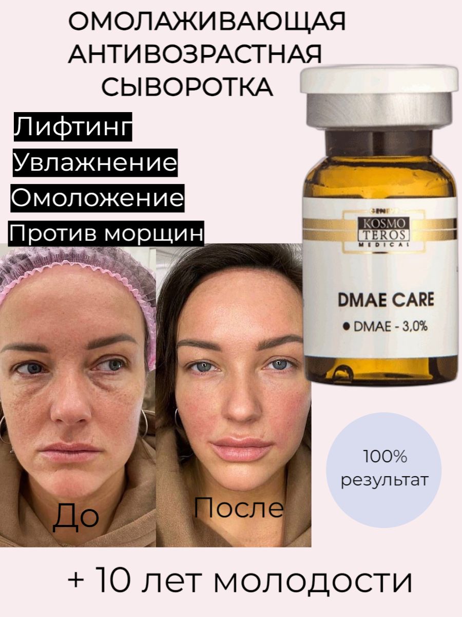 Дмае что это такое и для чего. ДМАЕ для лица результат. ДМАЕ от космотерос. DMAE мезотерапия космотерос.