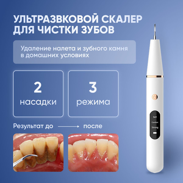 Скалер ультразвуковой для удаления зубного камня и налета. Прибор для ...