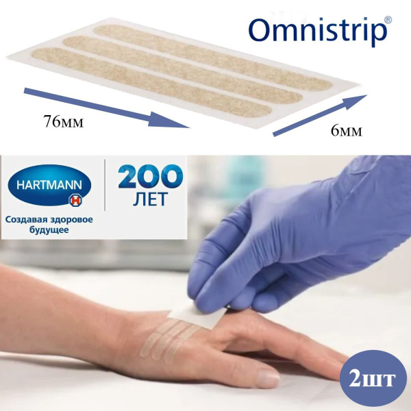 Пластырь-Стяжка Омнистрип (Omnistrip) гипоаллергенный 6х76мм - 2шт ...
