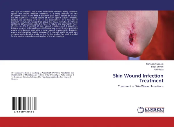 Обложка книги Skin Wound Infection Treatment, Samiyah Tasleem,Baqir Shyum and Abid Raza