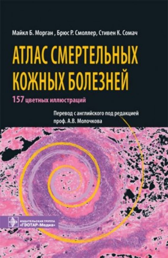 Морган, Смоллер, Сомач: Атлас смертельных кожных болезней