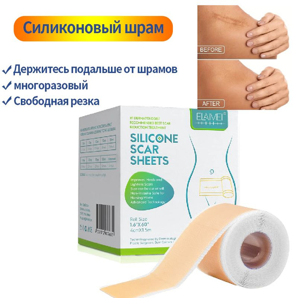 ELAIMEI Лейкопластырь силиконовый от шрамов и рубцов после КС и ...