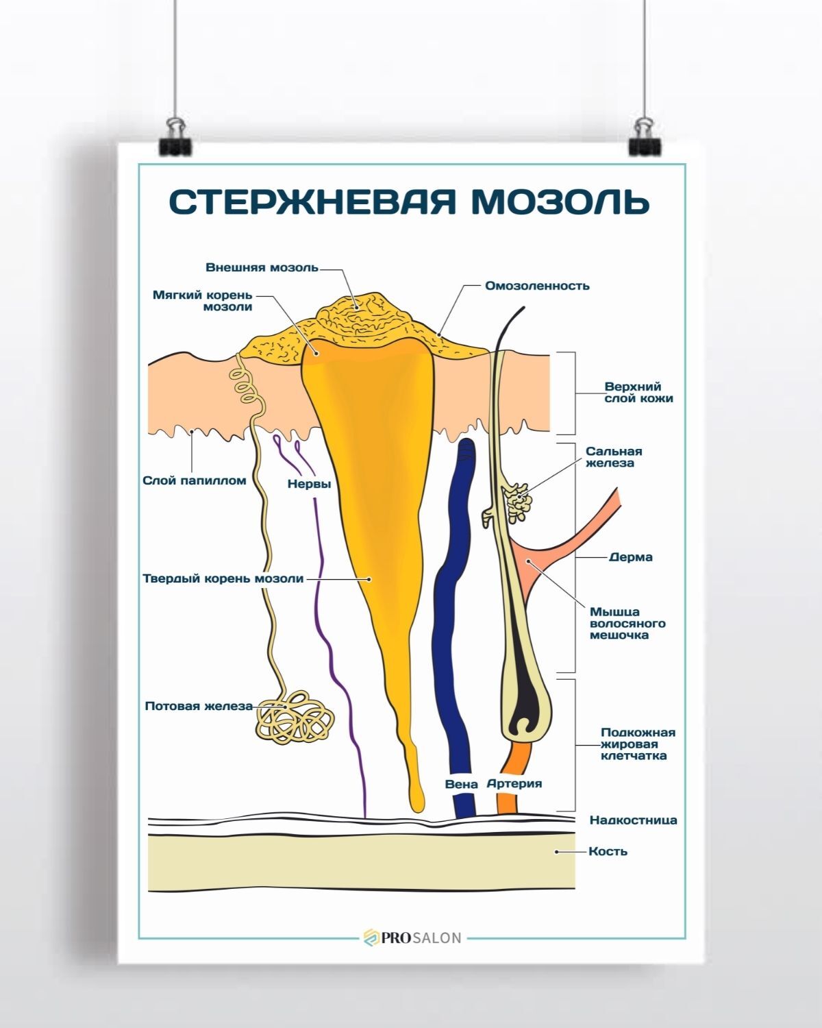 Стержневая мозоль фото корня