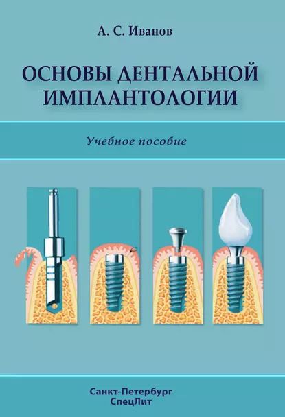 Основы дентальной имплантологии | Иванов Александр Сергеевич | Электронная книга