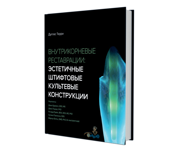 Внутрикорневые реставрации: эстетичные штифтовые культевые конструкции ...