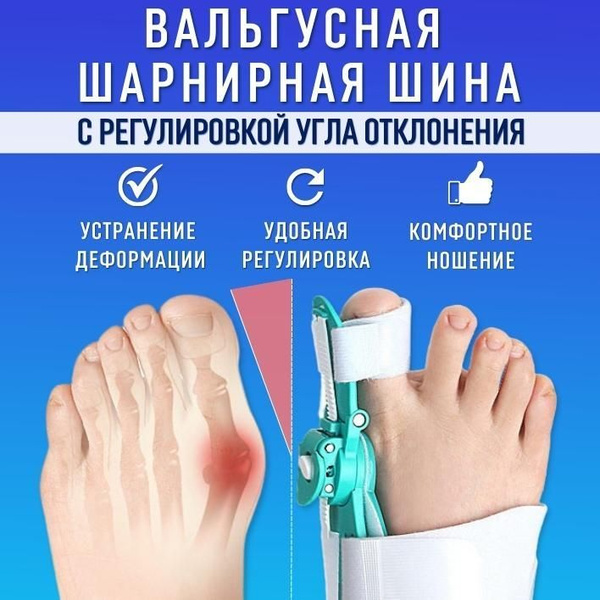 Вальгусная шарнирная шина ORTGUT SNAP FIX с регулировкой угла ...