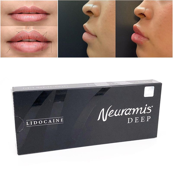 Препарат Нейрамис для увеличения губ отзывы. Скулы Нейрамис отзывы. Корея Neuramis Deep 1 ml отзывы. Neuramis филлер для губ цена отзывы.