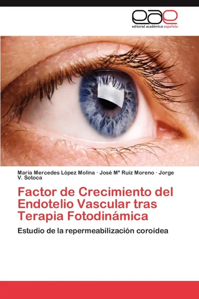 Обложка книги Factor de Crecimiento del Endotelio Vascular tras Terapia Fotodinamica, López Molina Maria Mercedes, Ruiz Moreno José Mª, Sotoca Jorge V.