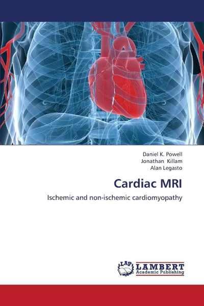 Обложка книги Cardiac MRI, Powell Daniel K., Killam Jonathan, Legasto Alan