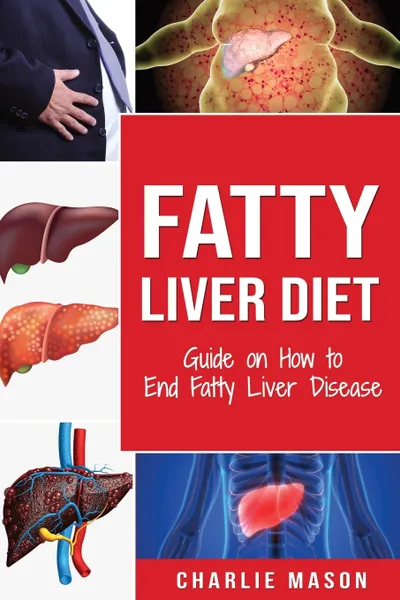 Обложка книги Fatty Liver Diet. Guide on How to End Fatty Liver Disease Fatty Liver Diet Books: Fatty Liver Diet (fatty liver diet for fatty liver Book, Charlie Mason