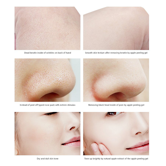 пилинг-скатка для лица корейская. пилинг скатка тони моли. скатка корейская для лица для подростков. пилинг гель скатка. корейская скатка для лица как пользоваться.