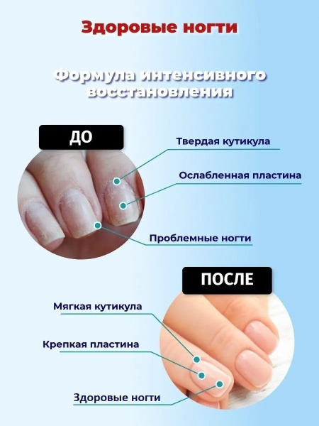 Eveline Лак для ногтей Эвелин 8в1 Здоровые ногти для укрепления и роста ...