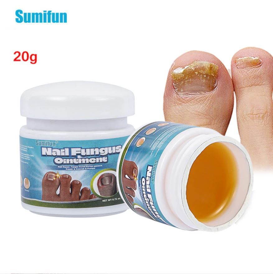 Мазь nail fungus. Противогрибковые мази для ногтей. Мазь nail fungus. Мазь nail fungus. Пилинг ногтей.
