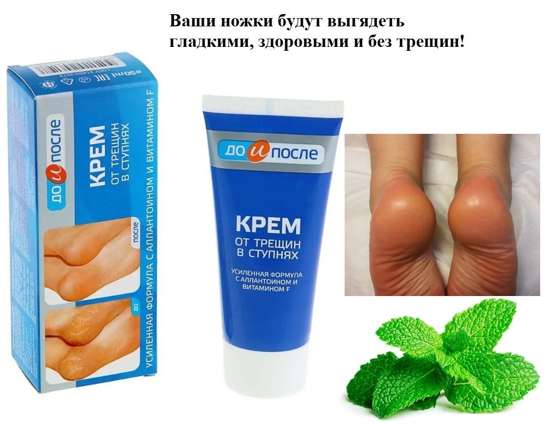 крем для ног от трещин в ступнях «до и после», 50 мл. до и после крем от трещин в ступнях 50 мл твинс тэк. крем для ног от трещин в ступнях. крем для ног от трещин в ступнях, "до и после", 150 мл. крем для ног от трещин в ступнях, "до и после", 150 мл.