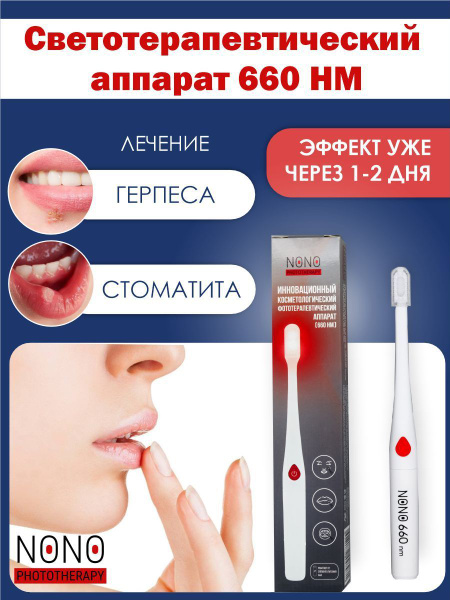 Аппарат NONO 660 от герпеса на губах, от стоматита, от генитального ...